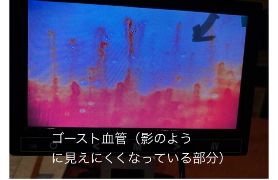 【12/8開催】その辛い冷え性、原因は「ゴースト血管」かも？自分の血液を見て対策を知る「血液観察会」｜二宮　はり灸養生院いのうえ